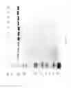 Fig. 91 - Compositions and Methods for Treating Collagen-Mediated Diseases