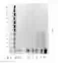 Fig. 92 - Compositions and Methods for Treating Collagen-Mediated Diseases