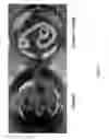 Fig. 04 - Biomaterial Compositions and Methods of Use