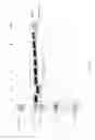Fig. 43 - Compositions and Methods for Treating Collagen-Mediated Diseases