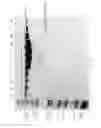 Fig. 46 - Compositions and Methods for Treating Collagen-Mediated Diseases