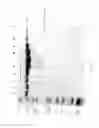 Fig. 48 - Compositions and Methods for Treating Collagen-Mediated Diseases