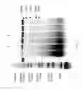 Fig. 72 - Compositions and Methods for Treating Collagen-Mediated Diseases