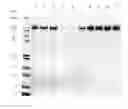 Fig. 76 - Compositions and Methods for Treating Collagen-Mediated Diseases
