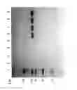 Fig. 84 - Compositions and Methods for Treating Collagen-Mediated Diseases