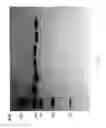 Fig. 85 - Compositions and Methods for Treating Collagen-Mediated Diseases