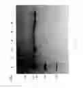 Fig. 86 - Compositions and Methods for Treating Collagen-Mediated Diseases