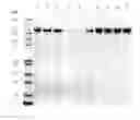 Fig. 76 - COMPOSITIONS AND METHODS FOR TREATING COLLAGEN-MEDIATED DISEASES