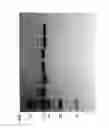 Fig. 85 - COMPOSITIONS AND METHODS FOR TREATING COLLAGEN-MEDIATED DISEASES