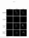 Fig. 04 - MSP2 ANTIGENIC PEPTIDES AND THEIR USE