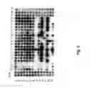 Fig. 11 - Neutralizing antibodies against GDF-8 and uses therefor