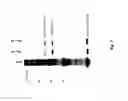 Fig. 12 - Neutralizing antibodies against GDF-8 and uses therefor