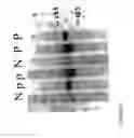 Fig. 04 - METHODS OF DIAGNOSING AND TREATING COMPLICATIONS OF PREGNANCY