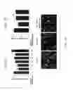 Fig. 03 - MATERIALS AND METHODS FOR PREVENTING OR TREATING NEURODEGENERATIVE CONDITIONS ASSOCIATED WITH ABETA PEPTIDE ACCUMULATION