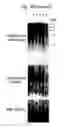 Fig. 37 - Therapeutic applications of p53 isoforms in regenerative medicine, aging and cancer