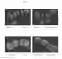 Fig. 05 - SURFACE PROTEINS OF STREPTOCOCCUS PYOGENES
