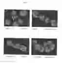 Fig. 06 - SURFACE PROTEINS OF STREPTOCOCCUS PYOGENES