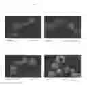 Fig. 07 - SURFACE PROTEINS OF STREPTOCOCCUS PYOGENES