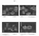 Fig. 08 - SURFACE PROTEINS OF STREPTOCOCCUS PYOGENES
