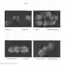 Fig. 09 - SURFACE PROTEINS OF STREPTOCOCCUS PYOGENES