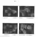 Fig. 10 - SURFACE PROTEINS OF STREPTOCOCCUS PYOGENES