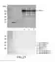 Fig. 34 - METHODS OF ENHANCING THE IMMUNOGENICITY OF MYCOBACTERIA AND COMPOSITIONS FOR THE TREATMENT OF CANCER, TUBERCULOSIS, AND FIBROSING LUNG DISEASES