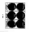 Fig. 02 - MICROSPHERE SKIN TREATMENT