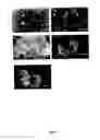 Fig. 02 - Sustained release drug delivery system