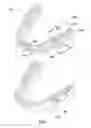 Fig. 02 - Systems and methods for orthodontic devices