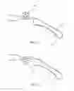 Fig. 06 - SEGMENTAL DISTALIZATION ELEMENT FOR ORTHODONTIC TREATMENTS