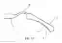 Fig. 07 - SEGMENTAL DISTALIZATION ELEMENT FOR ORTHODONTIC TREATMENTS