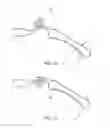 Fig. 08 - SEGMENTAL DISTALIZATION ELEMENT FOR ORTHODONTIC TREATMENTS