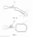 Fig. 09 - SEGMENTAL DISTALIZATION ELEMENT FOR ORTHODONTIC TREATMENTS
