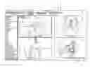 Fig. 01 - Method and system for orthodontic diagnosis