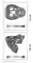 Fig. 10 - Method and system for orthodontic diagnosis