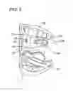 Fig. 04 - DEVICE FOR SELECTIVE TARGETING OF A SUBSTANCE TO A BODY PART