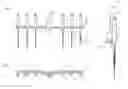 Fig. 02 - MEDICAL INSTRUMENT ASSEMBLY AND A METHOD OF MANUFACTURING THE SAME