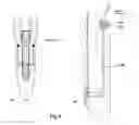 Fig. 05 - Tooth implant