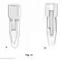 Fig. 15 - Tooth implant