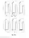 Fig. 16 - Tooth implant