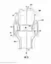 Fig. 10 - UNIVERSAL HEALING ABUTMENT