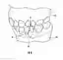 Fig. 12 - UNIVERSAL HEALING ABUTMENT