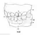 Fig. 13 - UNIVERSAL HEALING ABUTMENT