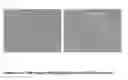 Fig. 04 - TOOTH REMINERALISATION