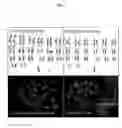 Fig. 08 - PRIMATE TOTIPOTENT AND PLURIPOTENT STEM CELLS PRODUCED BY SOMATIC CELL NUCLEAR TRANSFER