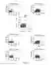 Fig. 03 - Cancer stem cell immortalization