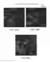 Fig. 31 - Cancer stem cell immortalization
