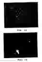 Fig. 11 - Plasmon resonant particles, methods and apparatus
