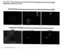 Fig. 03 - Cell-based detection of APF through its interaction with CKAP4 for diagnosis of interstitial cystitis