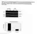 Fig. 05 - Cell-based detection of APF through its interaction with CKAP4 for diagnosis of interstitial cystitis